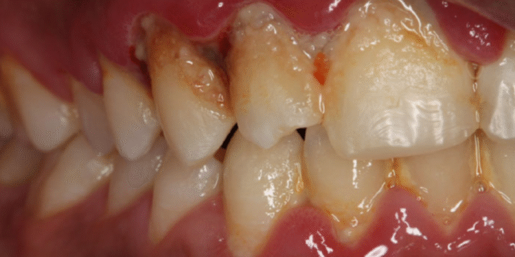 ThS.BS Nguyễn Quang Tiến – CEO Bệnh viện Răng Hàm Mặt Sài Gòn hướng dẫn cách xử lý khi lợi bị thâm đen