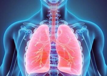 Căn bệnh gây tổn thương phổi gấp 3 lần hút thuốc