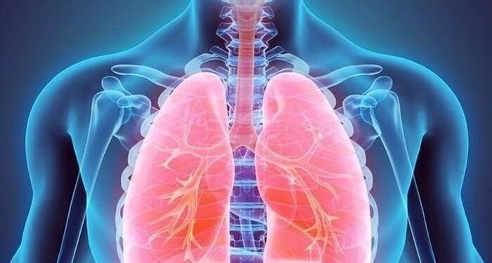 Căn bệnh gây tổn thương phổi gấp 3 lần hút thuốc