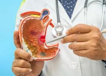 Nên và không nên ăn gì khi bị loét dạ dày?