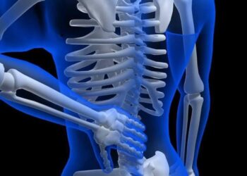 Viêm cột sống dính khớp có nguy hiểm không, những ai dễmắc bệnh?