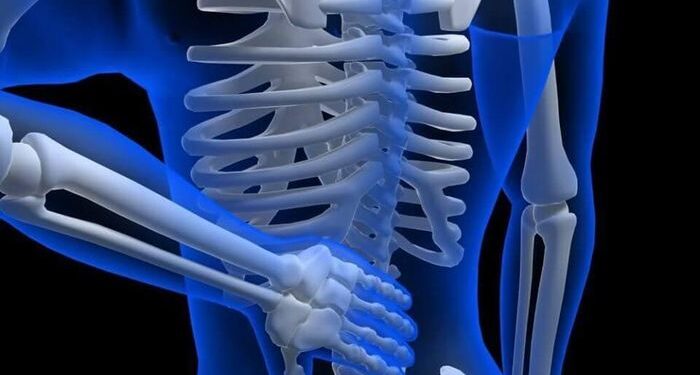 Viêm cột sống dính khớp có nguy hiểm không, những ai dễmắc bệnh?