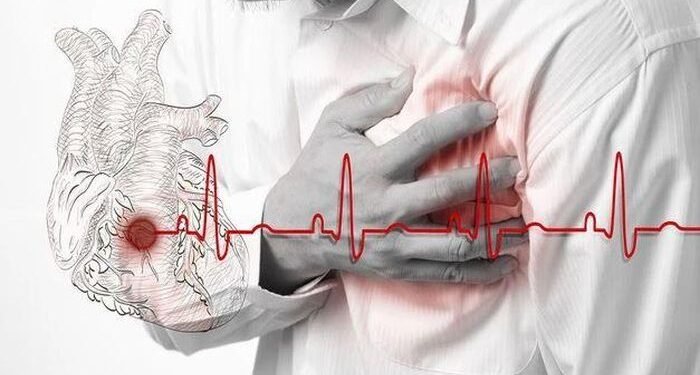 Đột tử và đột quỵ khác nhau thế nào, cách sơ cứu ra sao?