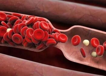 Phân tử tí hon giúp bạn tránh xa nhồi máu cơ tim