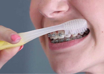 ThS.BS. Nguyễn Quang Tiến – CEO Bệnh viện Răng Hàm Mặt Sài Gòn: Một số sai lầm khi niềng răng nhiều người Việt thường xuyên mắc phải