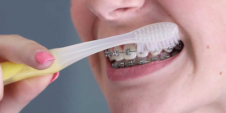 ThS.BS. Nguyễn Quang Tiến – CEO Bệnh viện Răng Hàm Mặt Sài Gòn: Một số sai lầm khi niềng răng nhiều người Việt thường xuyên mắc phải