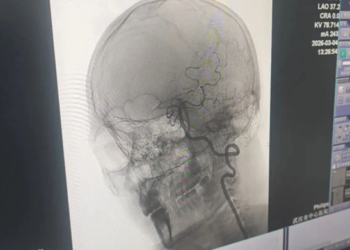 Người đàn ông 33 tuổi nguy kịch vì ham mát xa theo kiểu “chẳng giống ai”