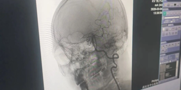 Người đàn ông 33 tuổi nguy kịch vì ham mát xa theo kiểu “chẳng giống ai”