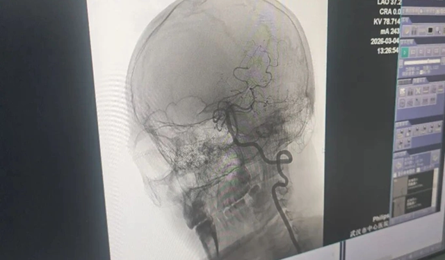Người đàn ông 33 tuổi nguy kịch vì ham mát xa theo kiểu “chẳng giống ai”