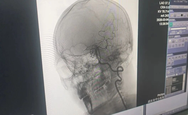 Người đàn ông 33 tuổi nguy kịch vì ham mát xa theo kiểu “chẳng giống ai”